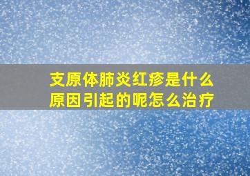 支原体肺炎红疹是什么原因引起的呢怎么治疗