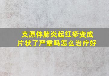 支原体肺炎起红疹变成片状了严重吗怎么治疗好