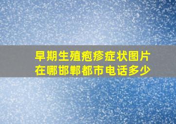 早期生殖疱疹症状图片在哪邯郸都市电话多少