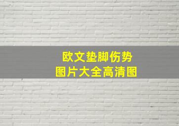 欧文垫脚伤势图片大全高清图