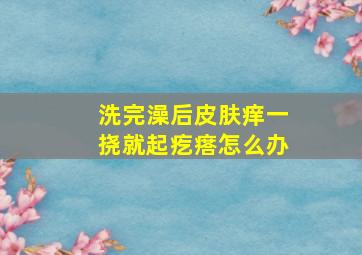 洗完澡后皮肤痒一挠就起疙瘩怎么办