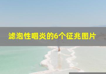 滤泡性咽炎的6个征兆图片