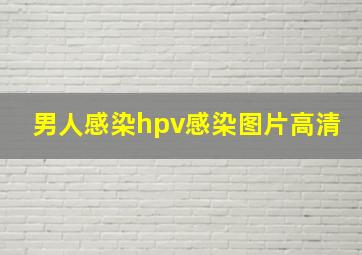 男人感染hpv感染图片高清