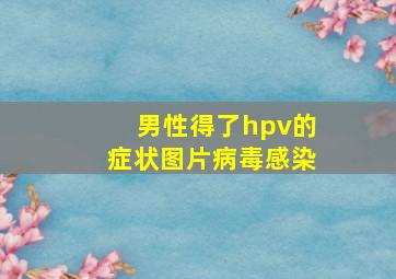 男性得了hpv的症状图片病毒感染