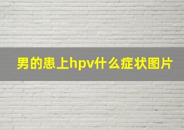 男的患上hpv什么症状图片