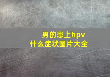 男的患上hpv什么症状图片大全