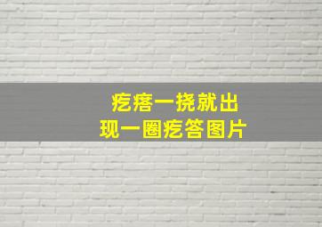 疙瘩一挠就出现一圈疙答图片