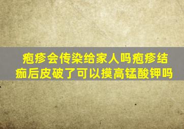 疱疹会传染给家人吗疱疹结痂后皮破了可以摸高锰酸钾吗