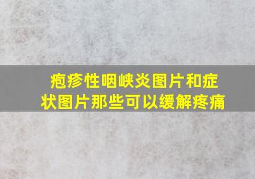 疱疹性咽峡炎图片和症状图片那些可以缓解疼痛