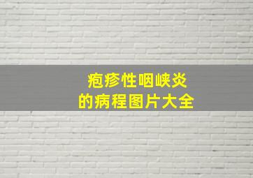 疱疹性咽峡炎的病程图片大全