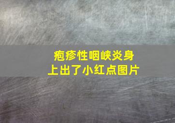 疱疹性咽峡炎身上出了小红点图片