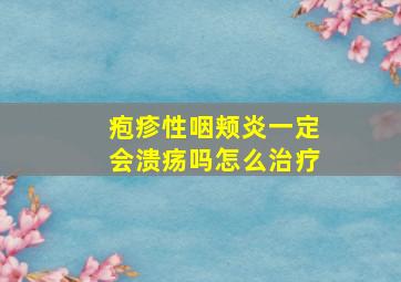 疱疹性咽颊炎一定会溃疡吗怎么治疗