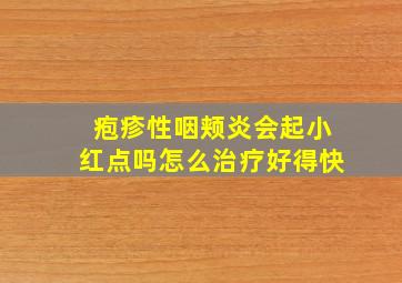 疱疹性咽颊炎会起小红点吗怎么治疗好得快