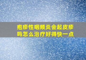 疱疹性咽颊炎会起皮疹吗怎么治疗好得快一点