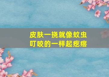 皮肤一挠就像蚊虫叮咬的一样起疙瘩