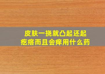 皮肤一挠就凸起还起疙瘩而且会痒用什么药