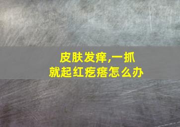 皮肤发痒,一抓就起红疙瘩怎么办