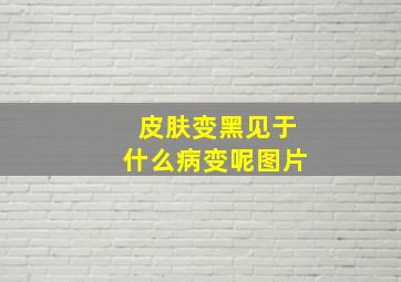 皮肤变黑见于什么病变呢图片