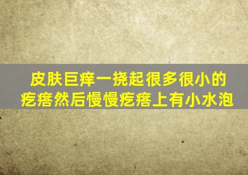 皮肤巨痒一挠起很多很小的疙瘩然后慢慢疙瘩上有小水泡