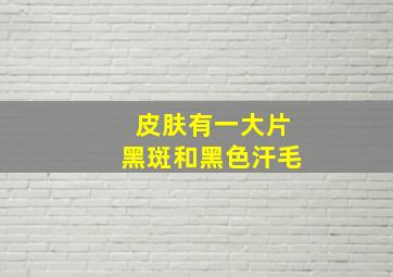 皮肤有一大片黑斑和黑色汗毛