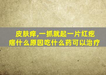 皮肤痒,一抓就起一片红疙瘩什么原因吃什么药可以治疗