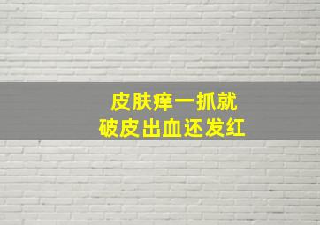 皮肤痒一抓就破皮出血还发红