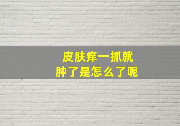 皮肤痒一抓就肿了是怎么了呢