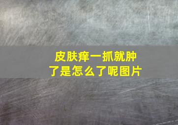 皮肤痒一抓就肿了是怎么了呢图片