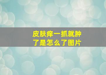 皮肤痒一抓就肿了是怎么了图片