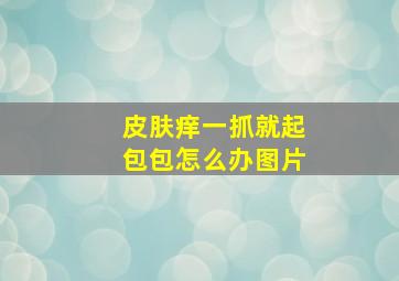 皮肤痒一抓就起包包怎么办图片