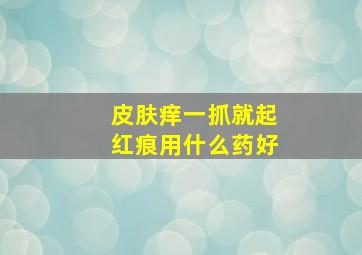 皮肤痒一抓就起红痕用什么药好