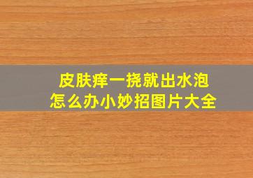 皮肤痒一挠就出水泡怎么办小妙招图片大全