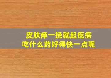 皮肤痒一挠就起疙瘩吃什么药好得快一点呢