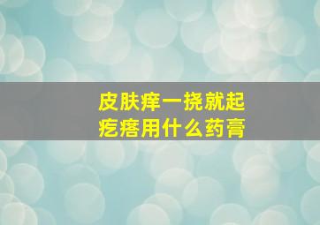 皮肤痒一挠就起疙瘩用什么药膏