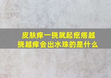 皮肤痒一挠就起疙瘩越挠越痒会出水珠的是什么