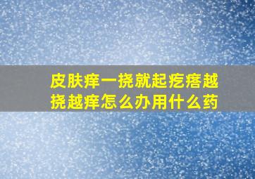 皮肤痒一挠就起疙瘩越挠越痒怎么办用什么药