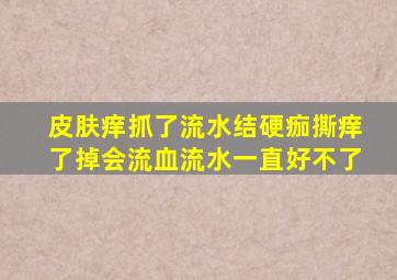 皮肤痒抓了流水结硬痂撕痒了掉会流血流水一直好不了