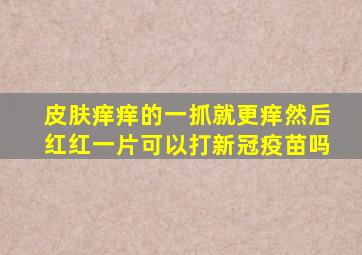 皮肤痒痒的一抓就更痒然后红红一片可以打新冠疫苗吗