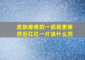 皮肤痒痒的一抓就更痒然后红红一片涂什么药