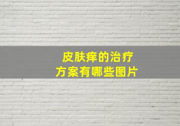 皮肤痒的治疗方案有哪些图片