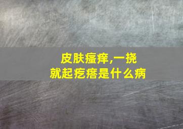 皮肤瘙痒,一挠就起疙瘩是什么病