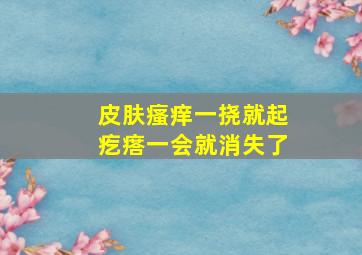 皮肤瘙痒一挠就起疙瘩一会就消失了