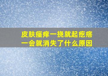 皮肤瘙痒一挠就起疙瘩一会就消失了什么原因