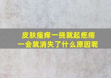 皮肤瘙痒一挠就起疙瘩一会就消失了什么原因呢