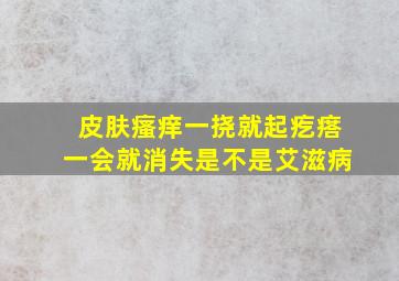 皮肤瘙痒一挠就起疙瘩一会就消失是不是艾滋病