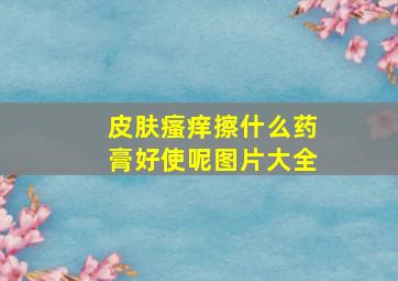 皮肤瘙痒擦什么药膏好使呢图片大全