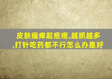 皮肤瘙痒起疙瘩,越抓越多,打针吃药都不行怎么办是好