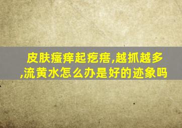 皮肤瘙痒起疙瘩,越抓越多,流黄水怎么办是好的迹象吗