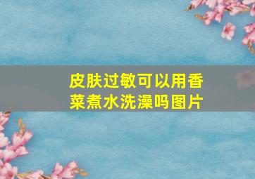 皮肤过敏可以用香菜煮水洗澡吗图片