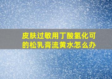 皮肤过敏用丁酸氢化可的松乳膏流黄水怎么办